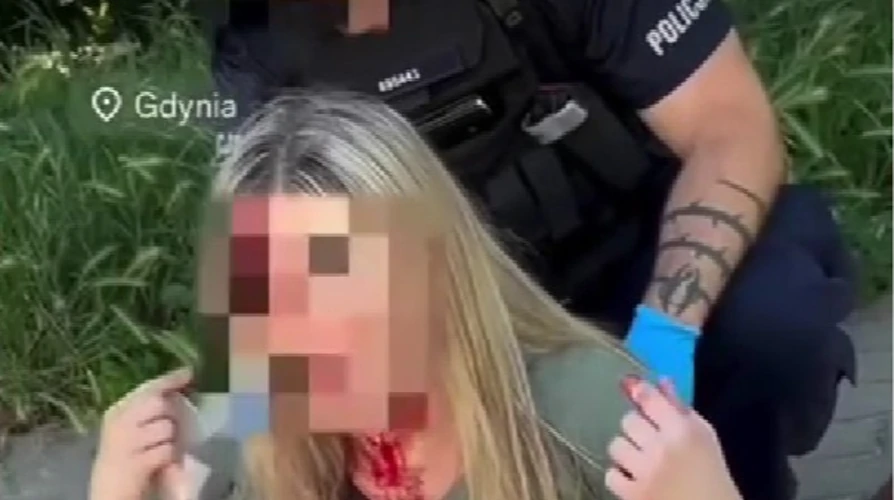 Постраждала українка в Польщі